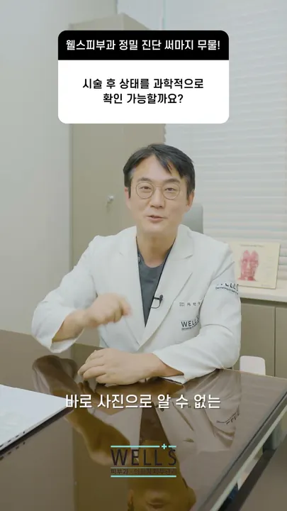Checking results after diagnostic Thermage